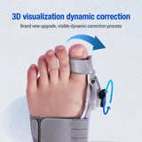 AlignPro Bunion Corrector - 50% OFF Until Stock Lasts!